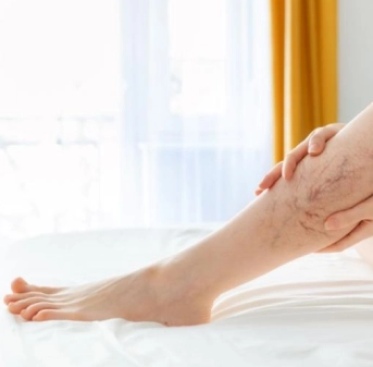 Подбор компрессионного трикотажа